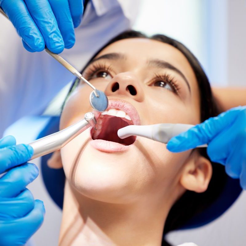 Dental Cleaning